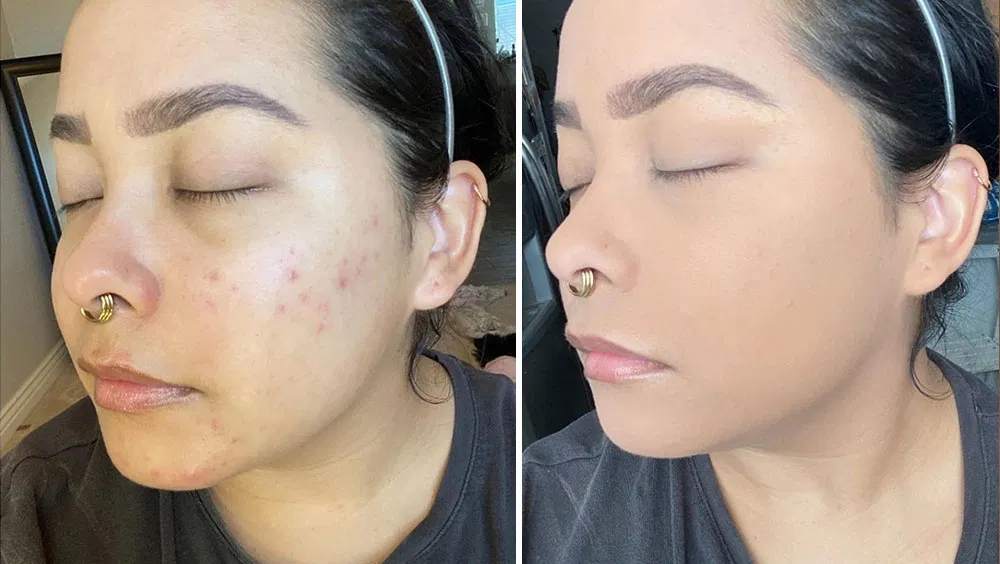 Flawless Skin: A Step-by-Step Guide to Dermaplaning at Home