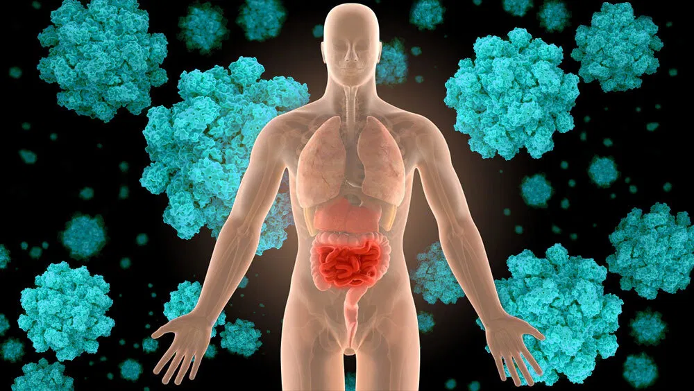Norovirus Symptoms