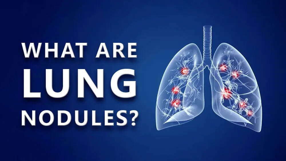 What Are Lung Nodules?