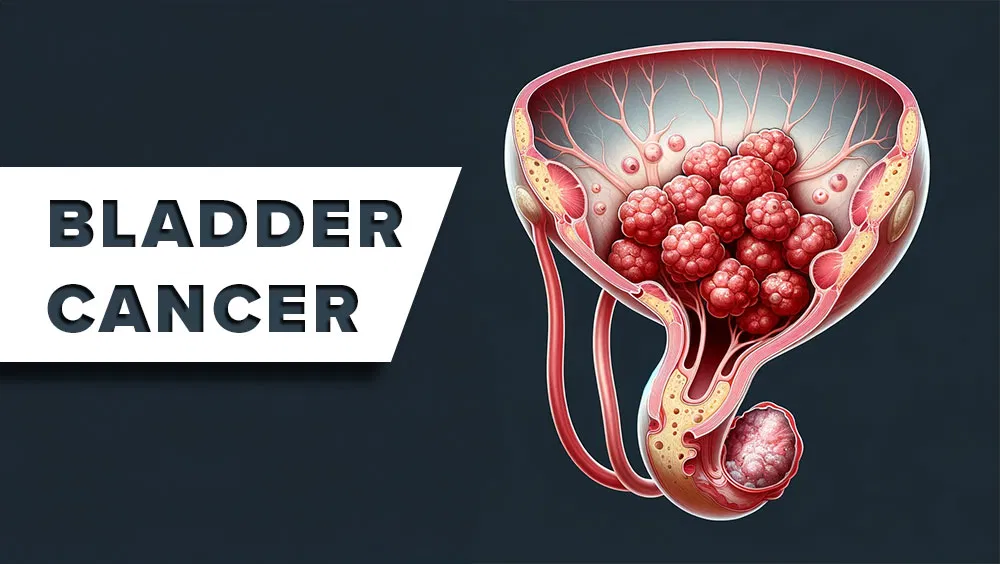 Bladder Cancer Signs & Symptoms