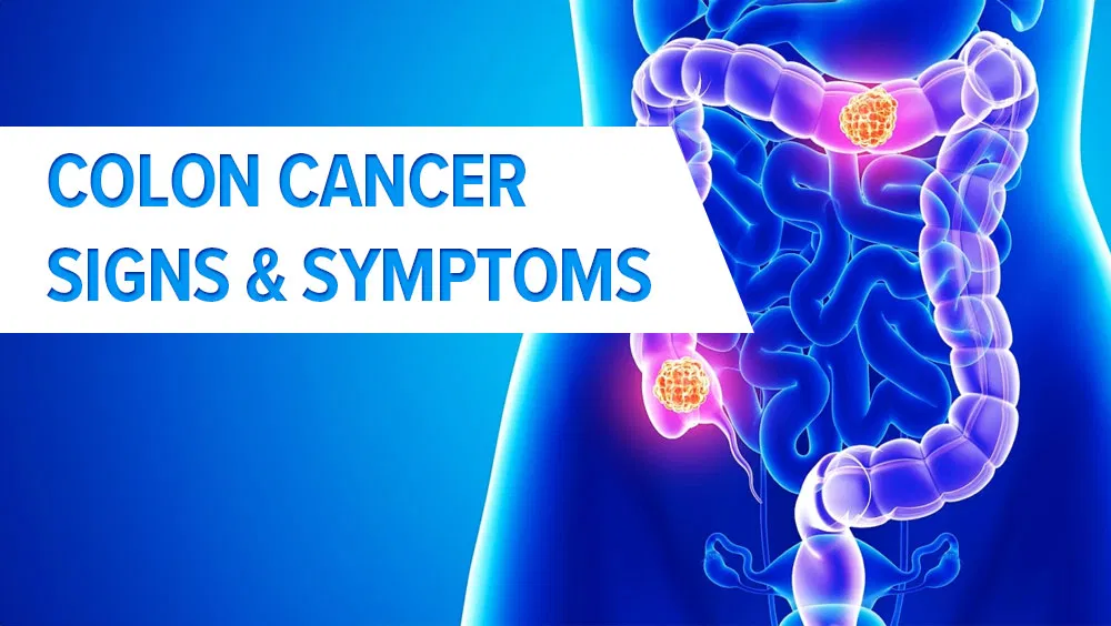 Colon Cancer Signs & Symptoms