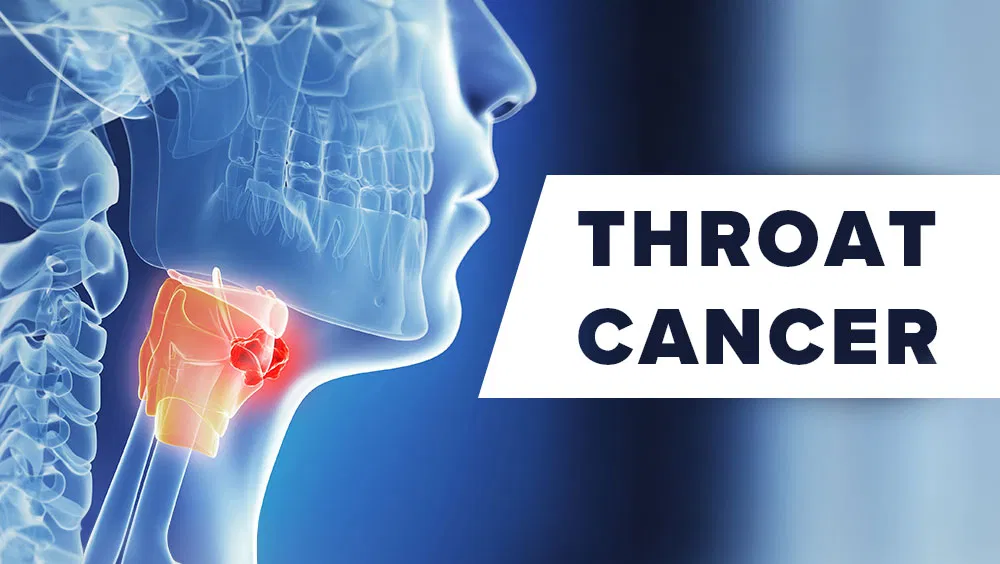 Throat Cancer Signs & Symptoms