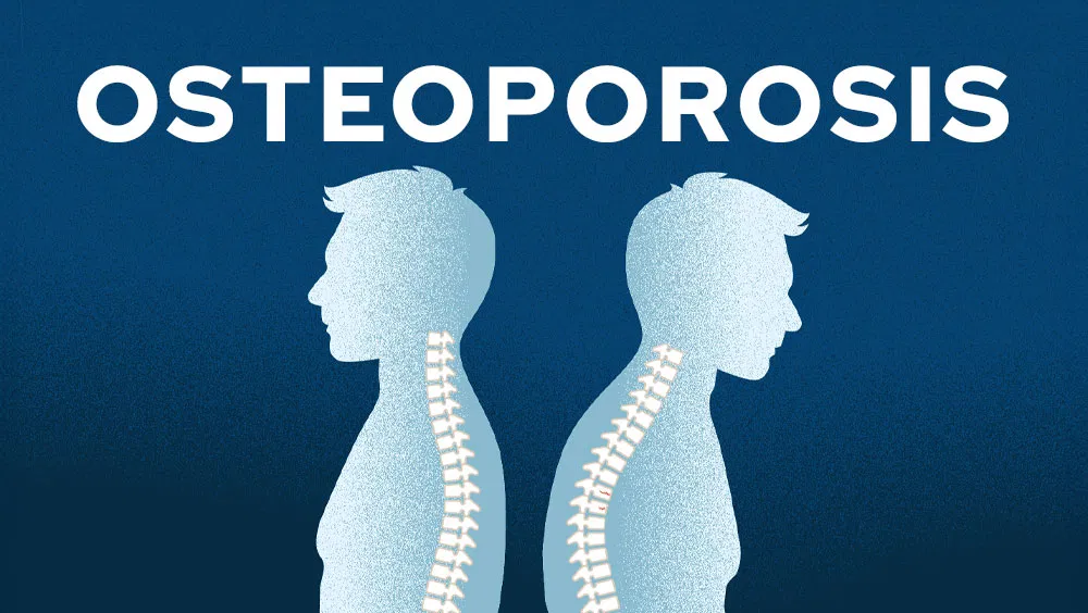 Osteoporosis Symptoms