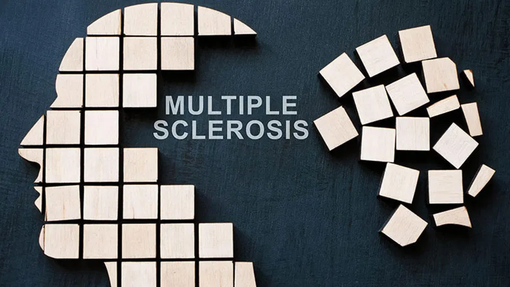 Signs Of Multiple Sclerosis (MS)