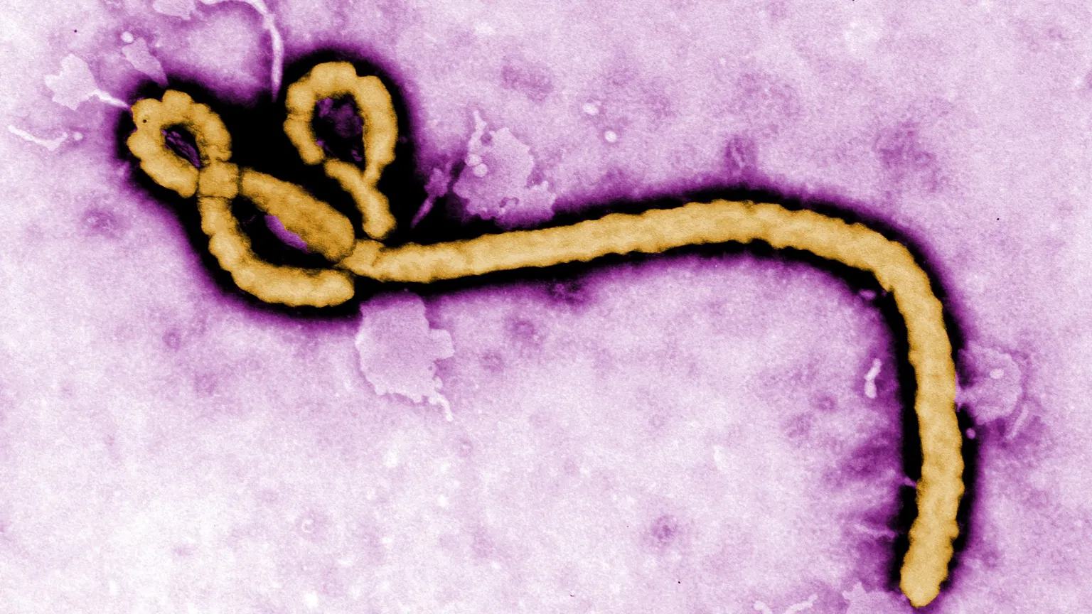 Ebola Virus Explained: Symptoms, Transmission, and the 2026 Outbreak