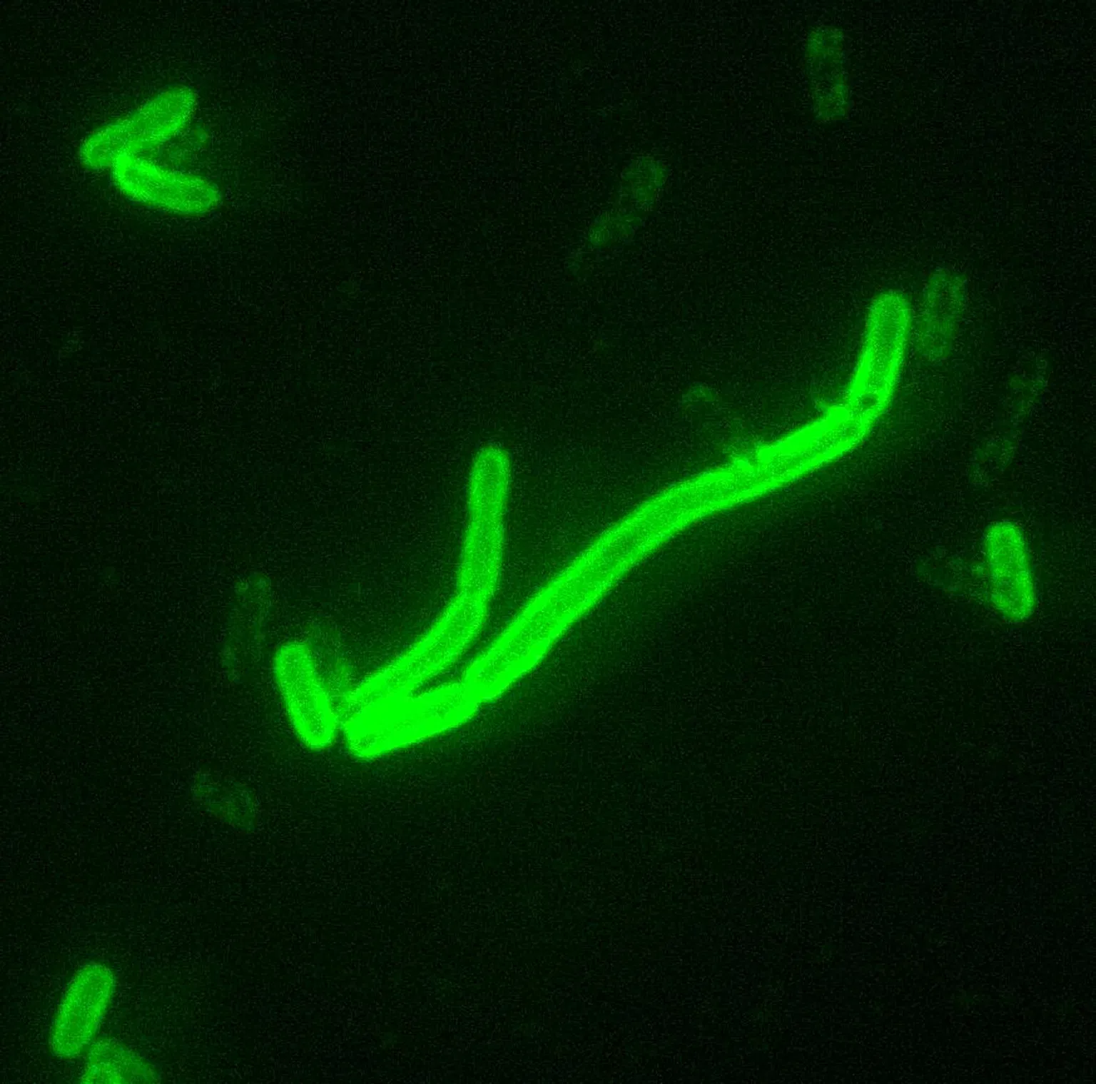 Pneumonic Plague: Russia Lab Worker's Death Explained