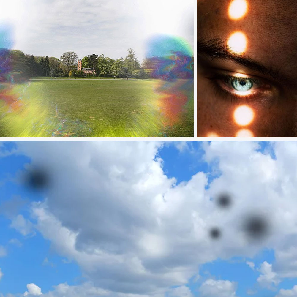 Shapes Moving Across Your Field Of Vision