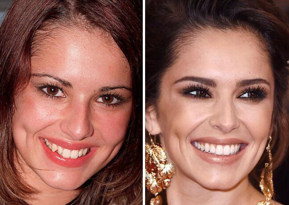 Cheryl Cole