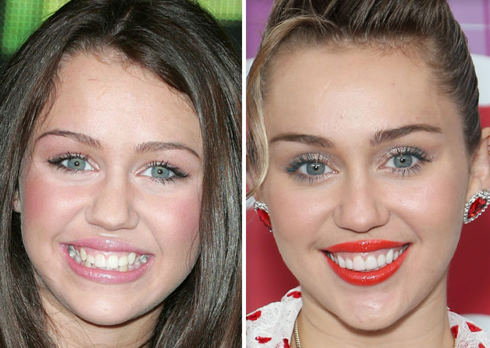 Miley Cyrus 1