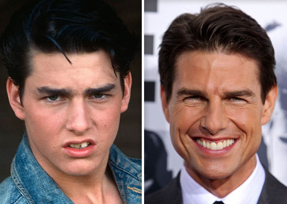 Tom Cruise 1