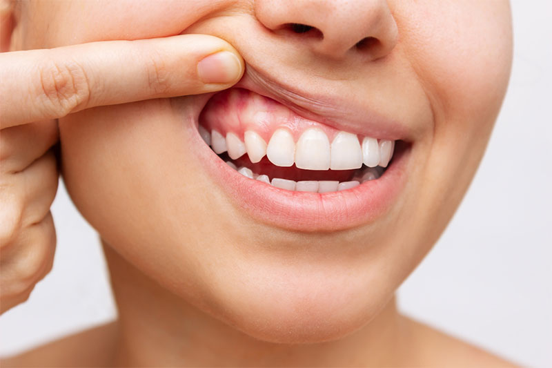 You Want to Improve Your Gum Health