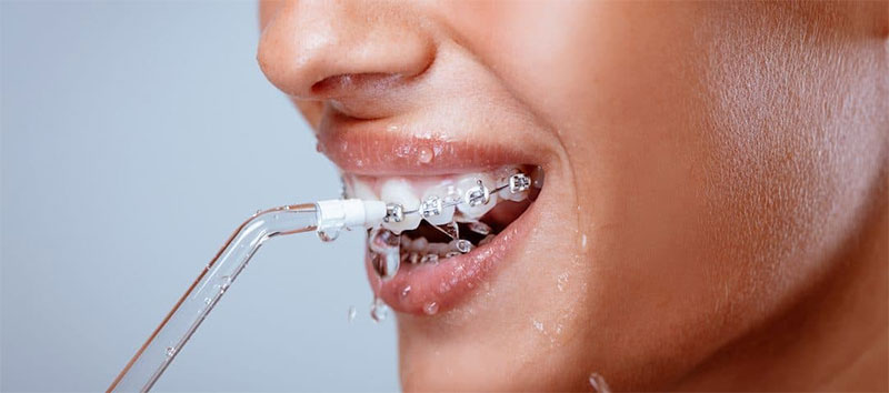 You Wear Braces