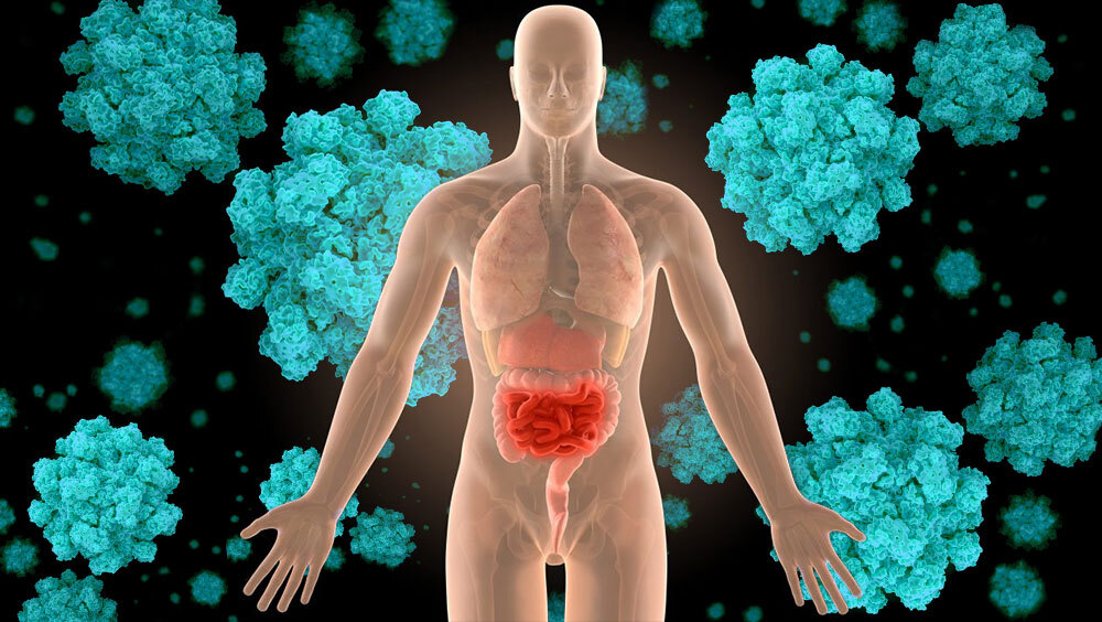 Norovirus Symptoms