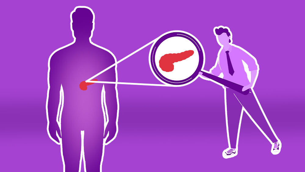 Pancreatic Cancer Signs