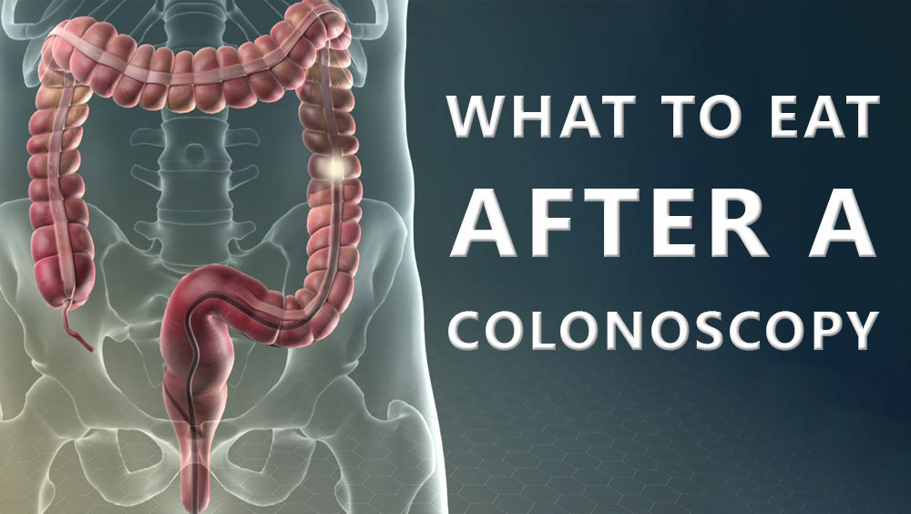 What To Eat After A Colonoscopy