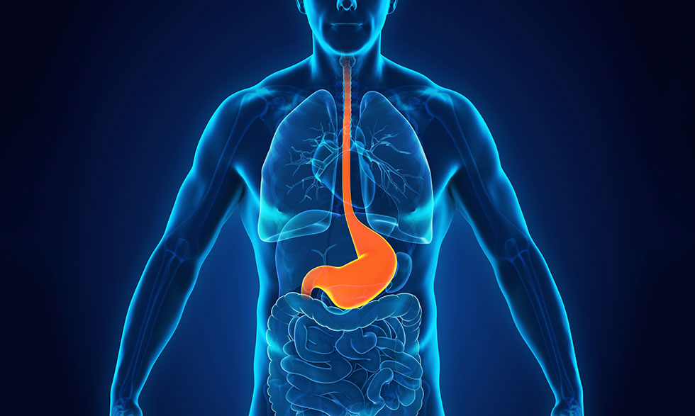 Acid Reflux