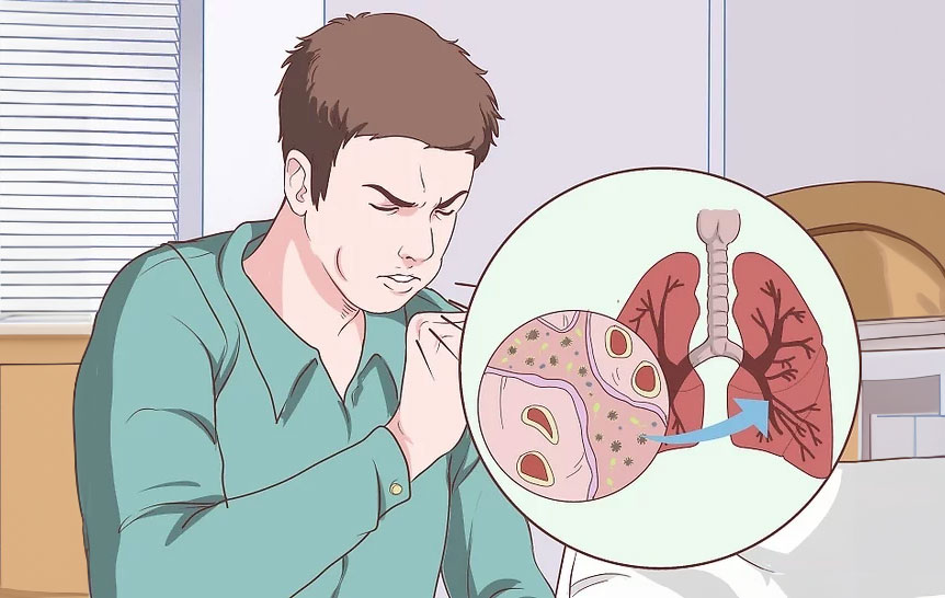 Symptoms 2
