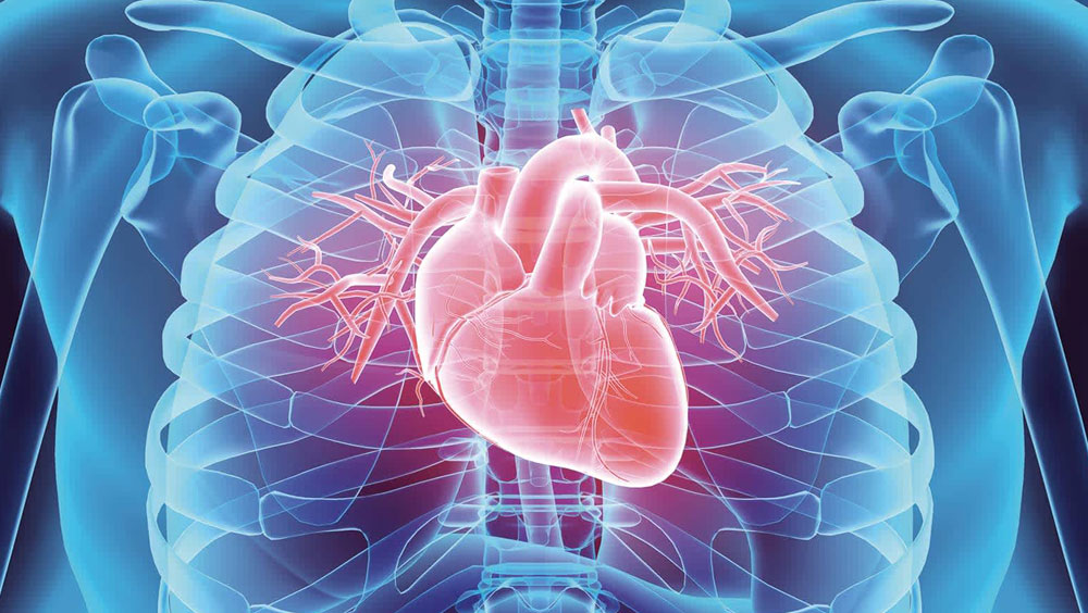 What Is An Enlarged Heart