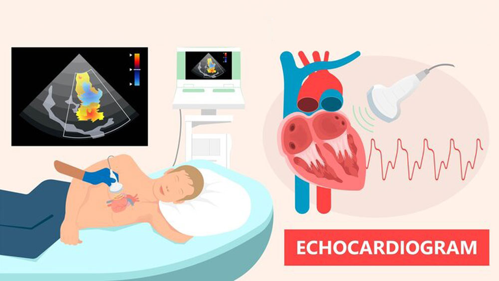 FAQs About An Echocardiogram