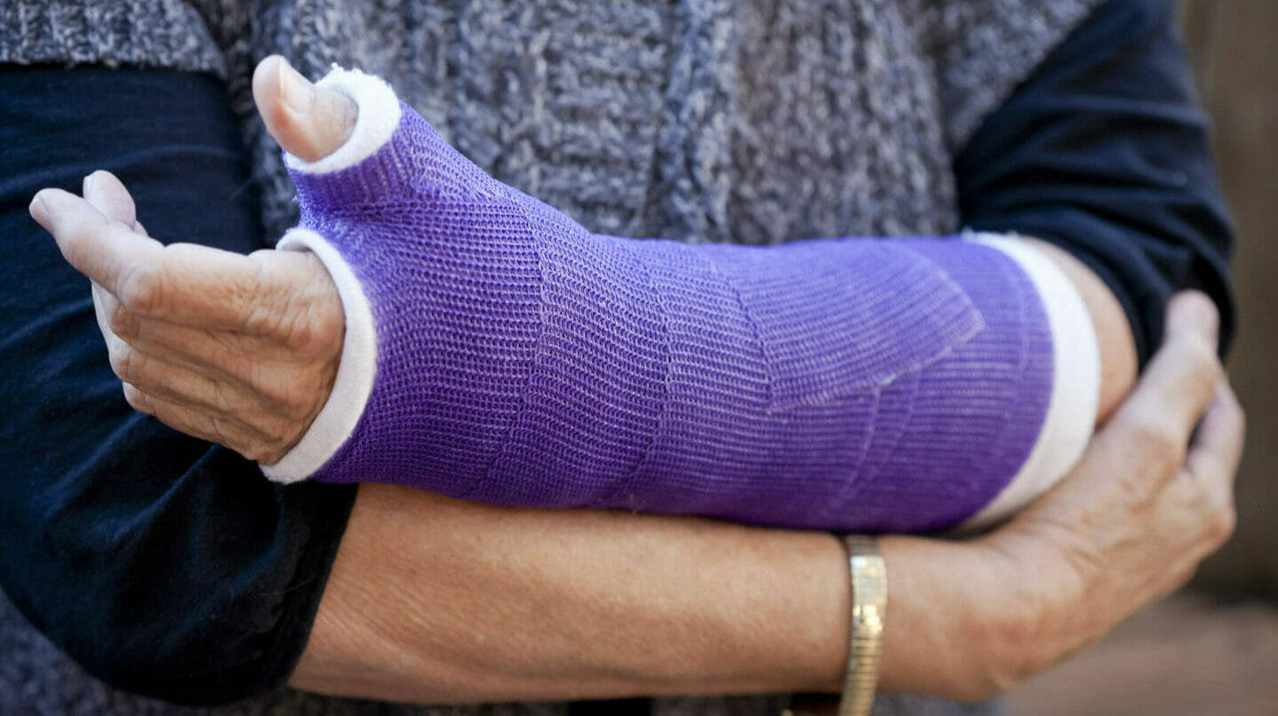 cast