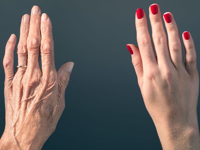 hands and nails aging 0 1506431521
