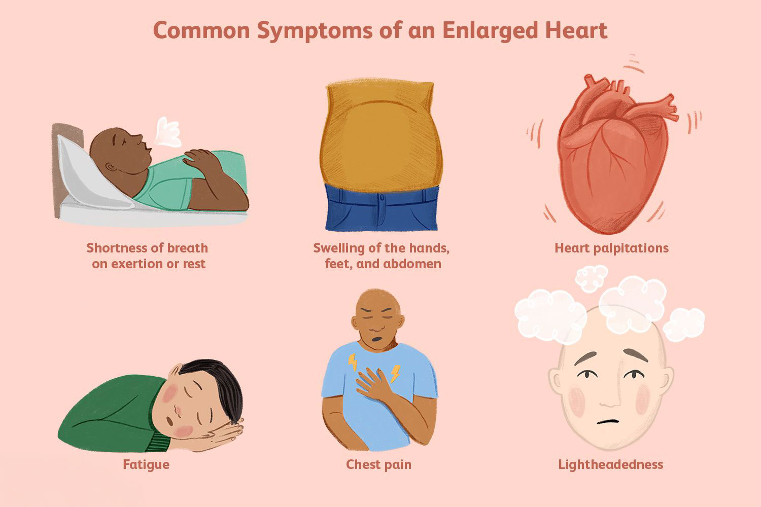 symptoms of an enlarged heart 5181653 FINAL b7ab9543fafd4f68be5b71762abdf3e7