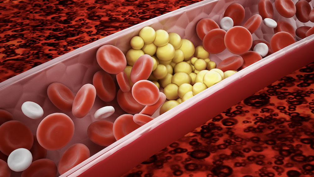 Why Are Triglycerides Important