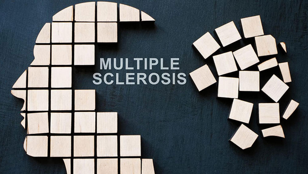 Signs Of Multiple Sclerosis (MS)