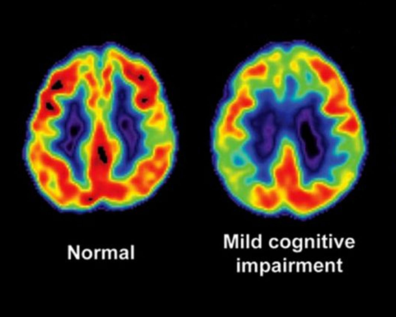when you should go see a neurologist_bdff9743 4eea 4516 a179 c409d701aef5