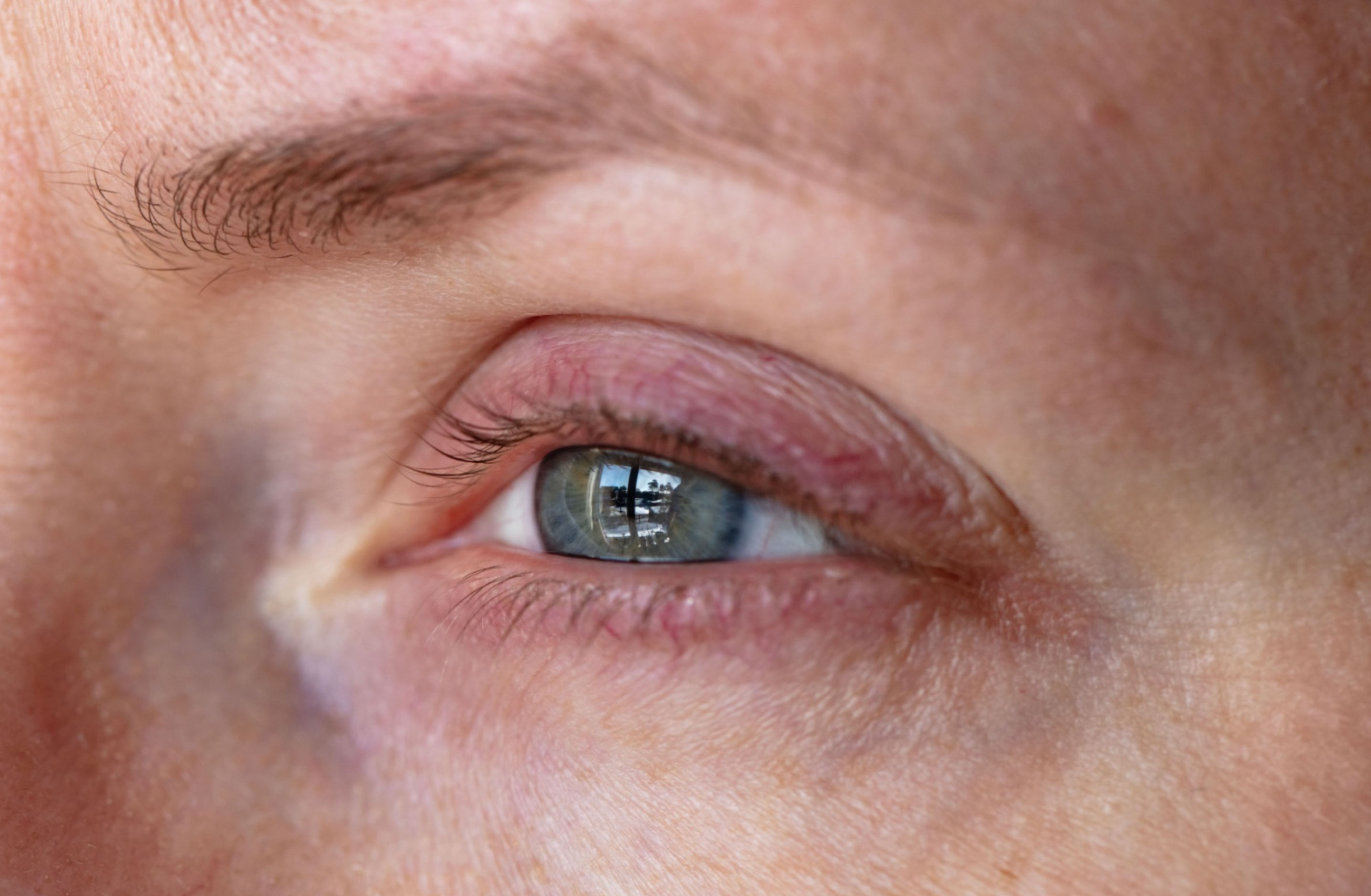 why your eyes burn when you cry_39d347fd 981f 4fed 9062 6830173285f9