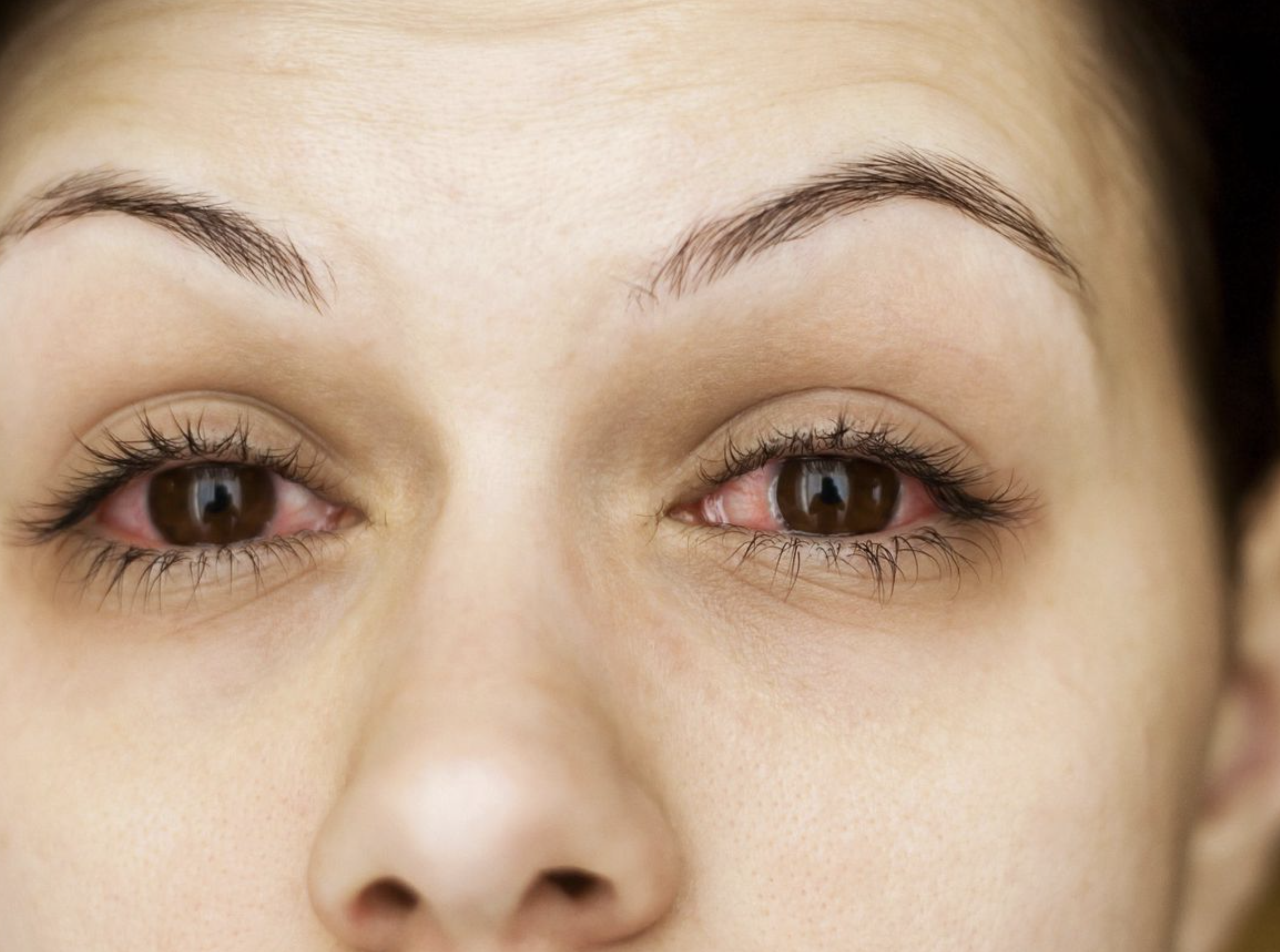 why your eyes burn when you cry_6f4cf417 594a 490d b6f5 cce26a1ee93c