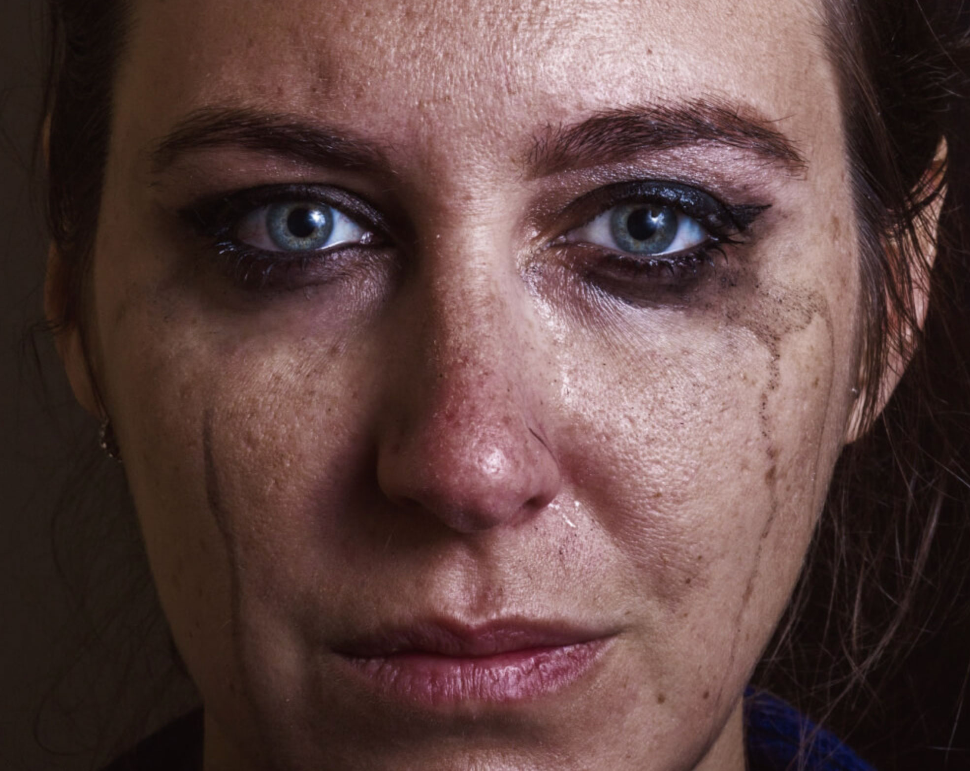 why your eyes burn when you cry_a3f2f0b3 988b 4c5b 9e77 64b28b60e08b