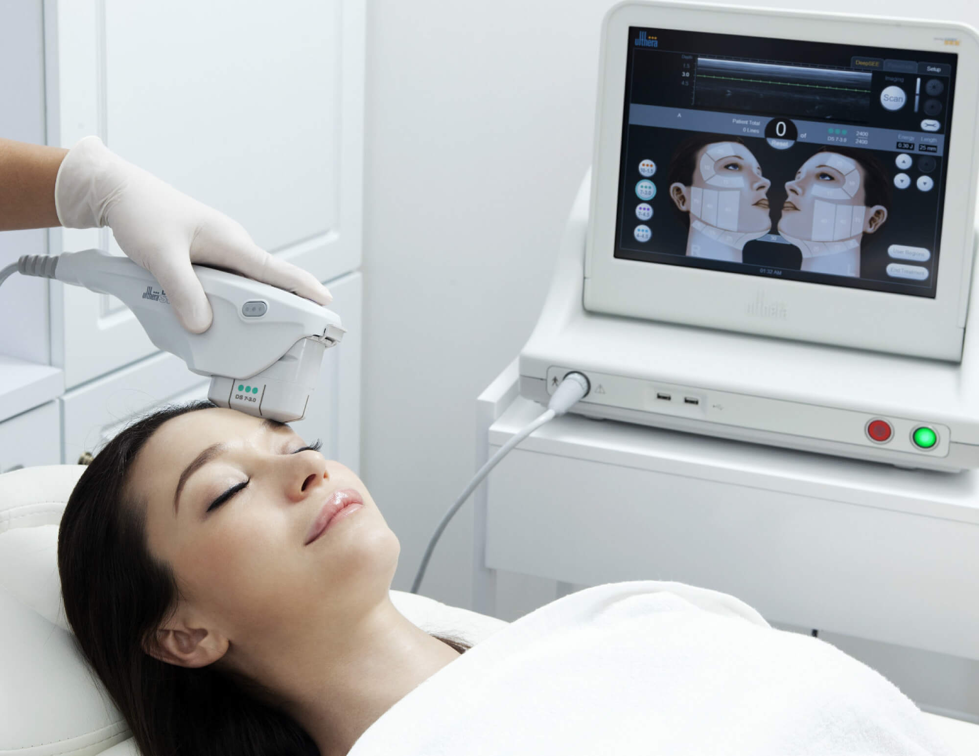 Costos de Ultherapy: Lo Que Debes Saber Antes de Un Lifting Sin Cirugía