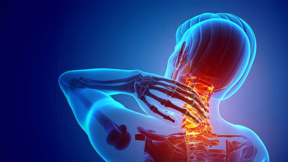 \How To Deal With Pinched Nerve