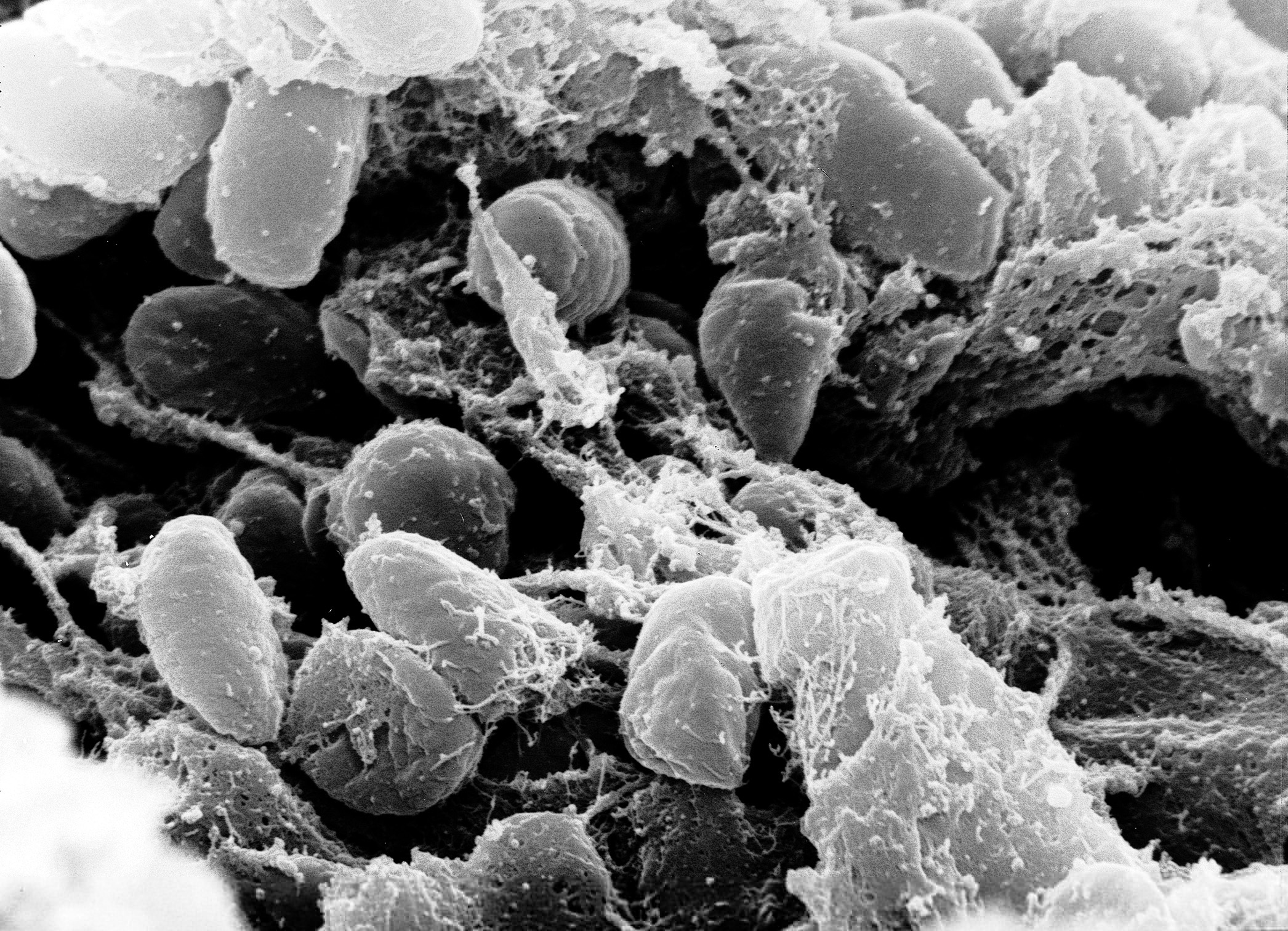 1791211236355_Yersinia_pestis
